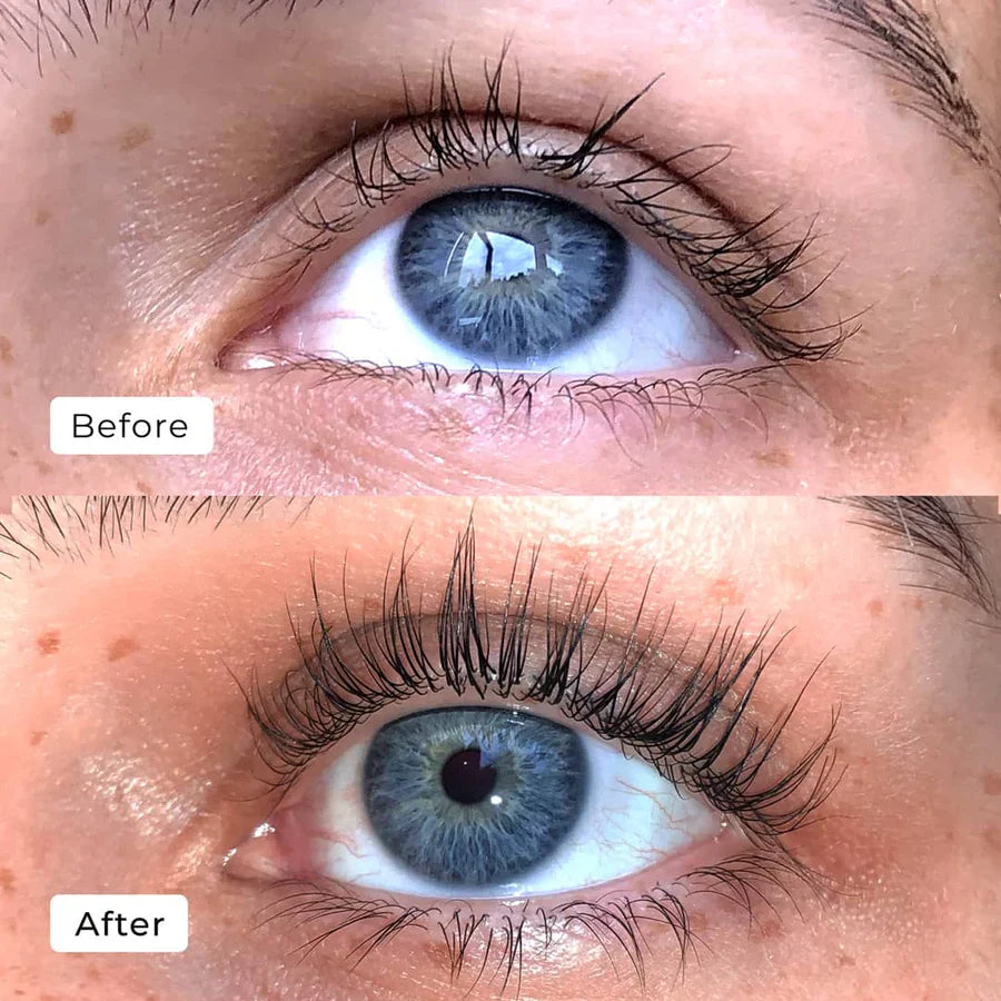 Kaylash™ | Wachstum Serum