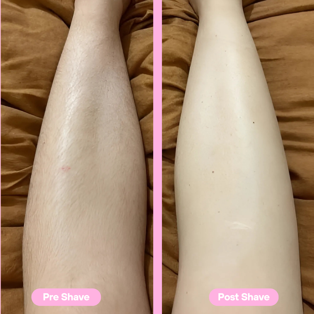 SmoothShave™  | Pro Shaver