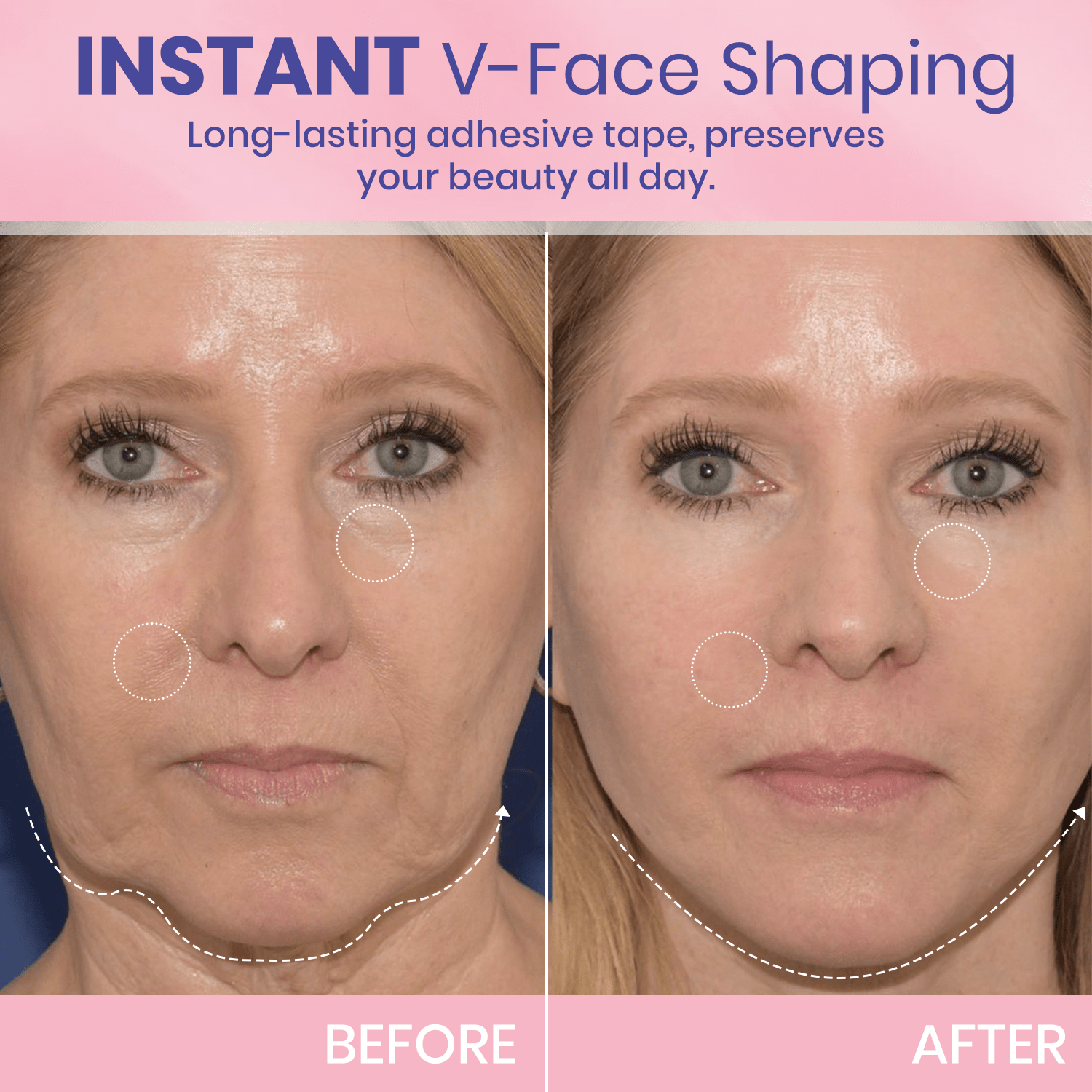 OUHOE™ | V-Face Lift Klebeband | Gesichtsstraffende unsichtbare Klebebänder (40 stucks)