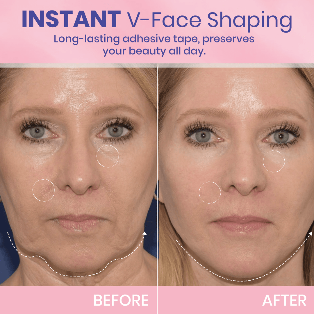 OUHOE| V-Face Lift Klebeband| Gesichtsstraffende unsichtbare Klebebänder (40 stucks)