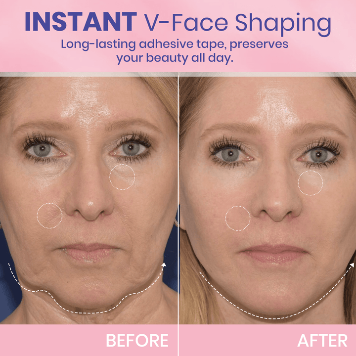 OUHOE| V-Face Lift Klebeband| Gesichtsstraffende unsichtbare Klebebänder (40 stucks)
