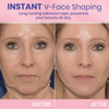 OUHOE™ | V-Face Lift Klebeband | Gesichtsstraffende unsichtbare Klebebänder (40 stucks)