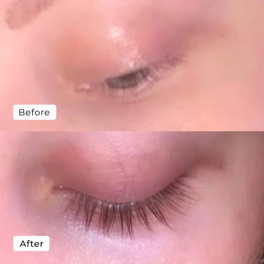 Kaylash™ | Wachstum Serum