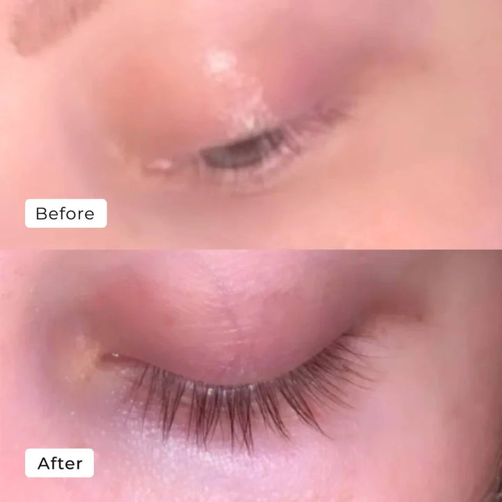 Kaylash™ | Wachstum Serum
