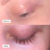 Kaylash™ | Wachstum Serum