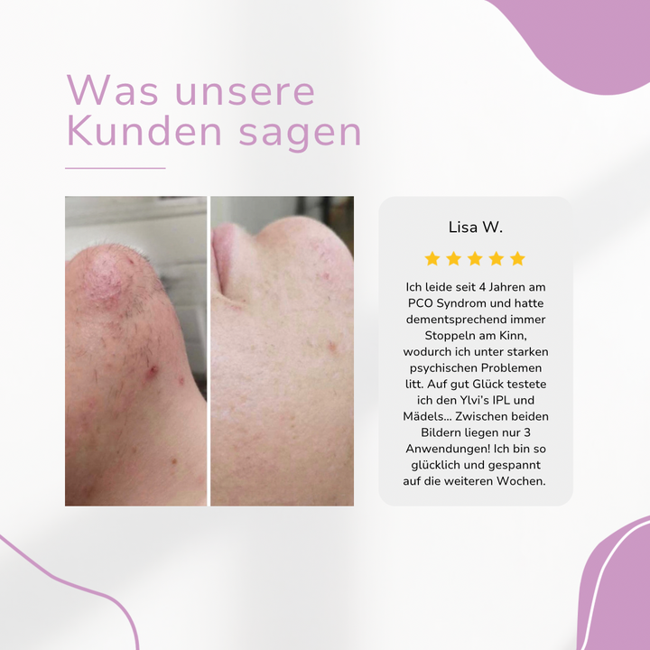 LaserTouch™ – Salonqualität für Ihre Haarentfernung zuhause