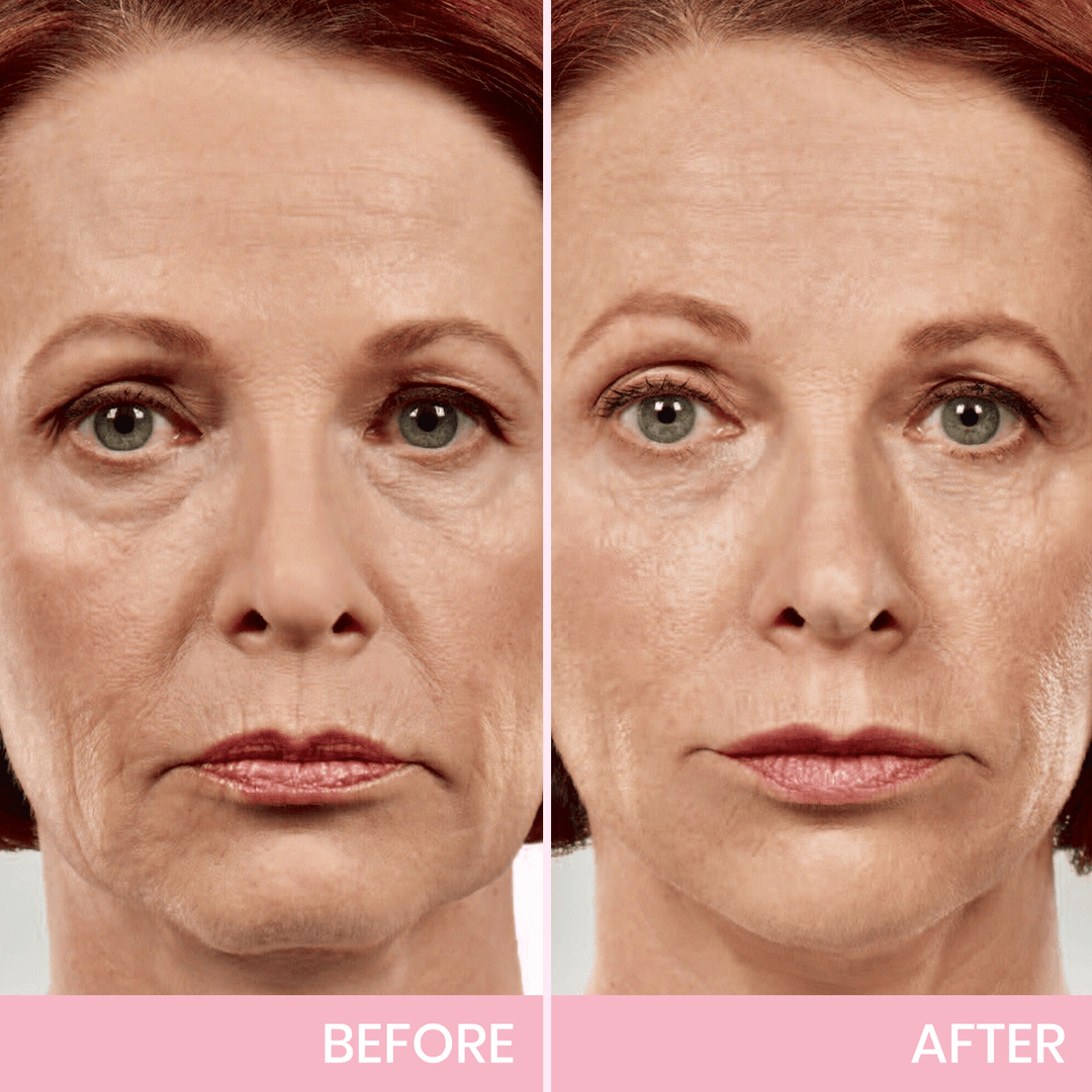 OUHOE| V-Face Lift Klebeband| Gesichtsstraffende unsichtbare Klebebänder (40 stucks)