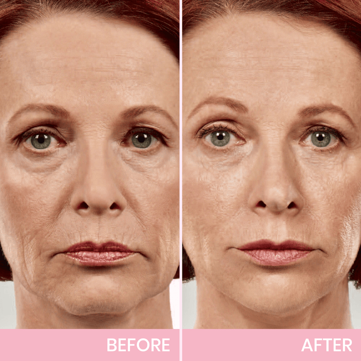 OUHOE| V-Face Lift Klebeband| Gesichtsstraffende unsichtbare Klebebänder (40 stucks)