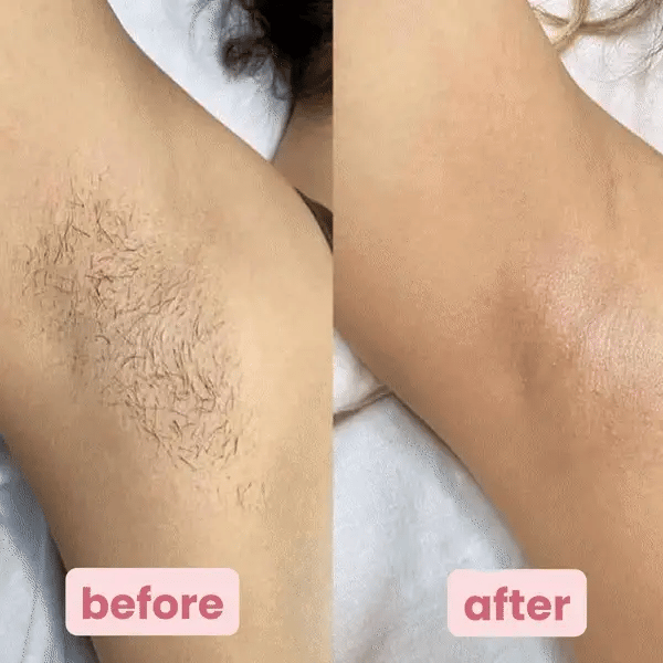 SmoothShave™  | Pro Shaver
