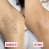 SmoothShave™  | Pro Shaver