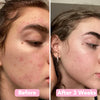 Kurkuma - und Kojic-Säure Pads | 40 Stück