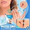 TagAway™ Fortgeschrittenes Set zur Entfernung von Hautwucherungen