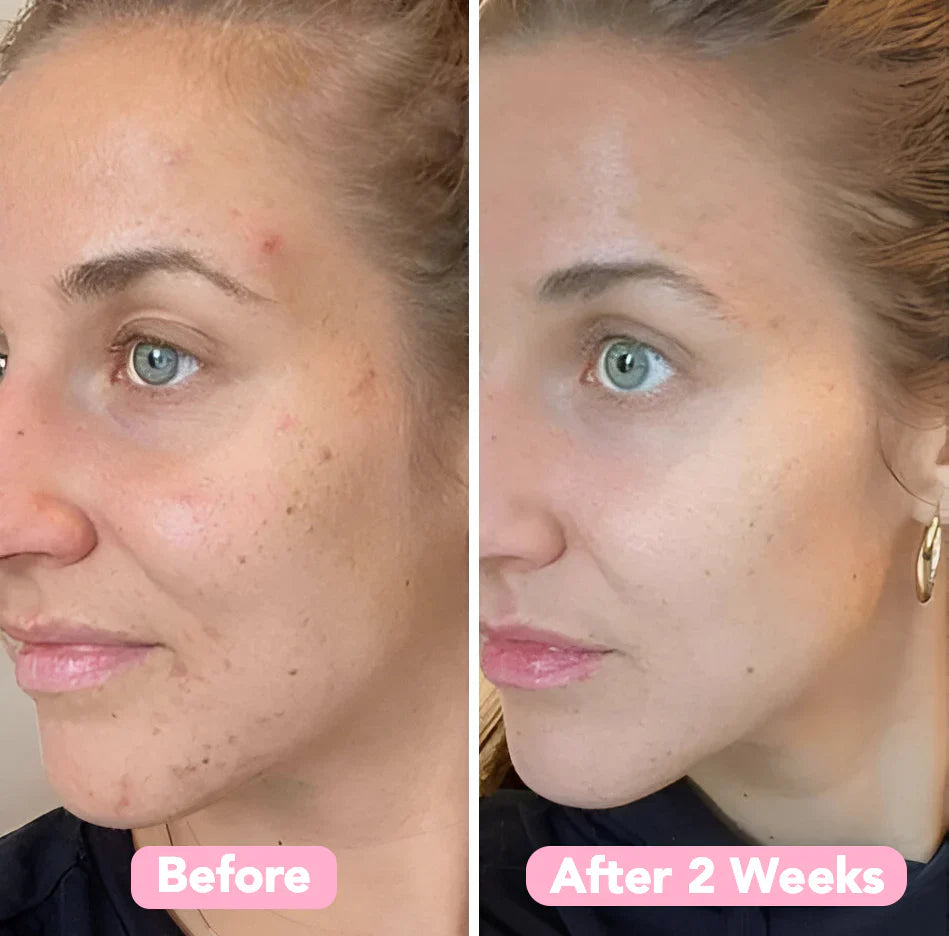 Kurkuma - und Kojic-Säure Pads | 40 Stück