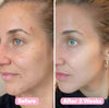 Kurkuma - und Kojic-Säure Pads | 40 Stück