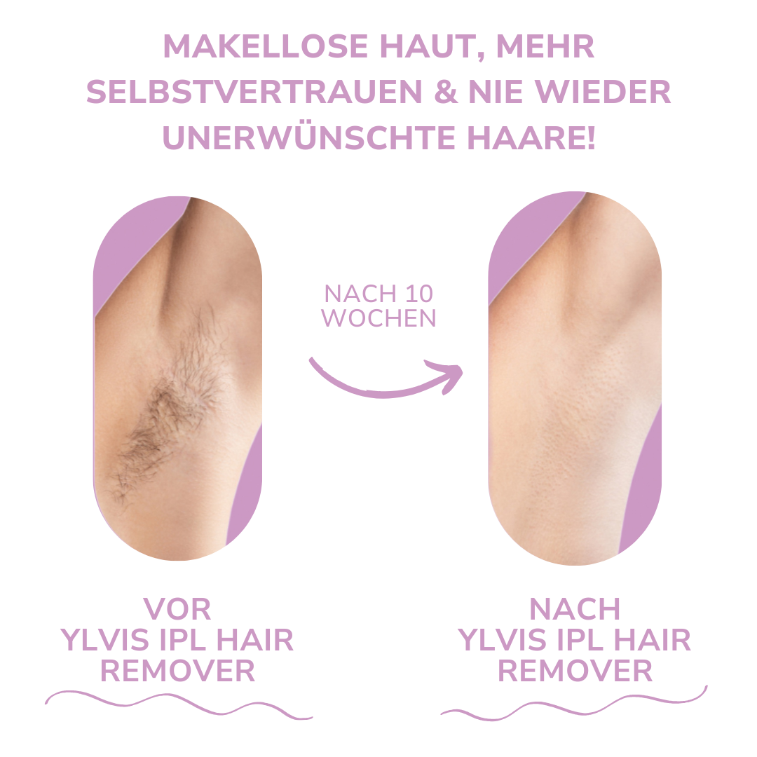 LaserTouch™ – Salonqualität für Ihre Haarentfernung zuhause