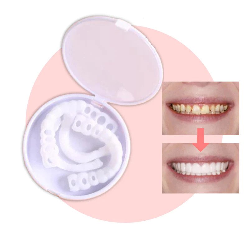 Snap-on Zähne - Mit diesen Veneers immer das perfekte Lächeln