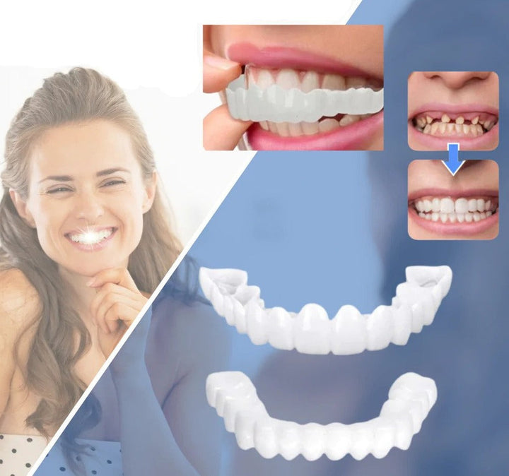 Snap-on Zähne - Mit diesen Veneers immer das perfekte Lächeln