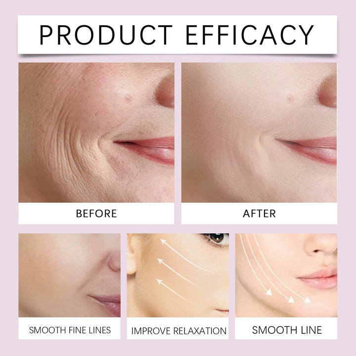OUHOE| V-Face Lift Klebeband| Gesichtsstraffende unsichtbare Klebebänder (40 stucks)