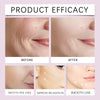 OUHOE™ | V-Face Lift Klebeband | Gesichtsstraffende unsichtbare Klebebänder (40 stucks)