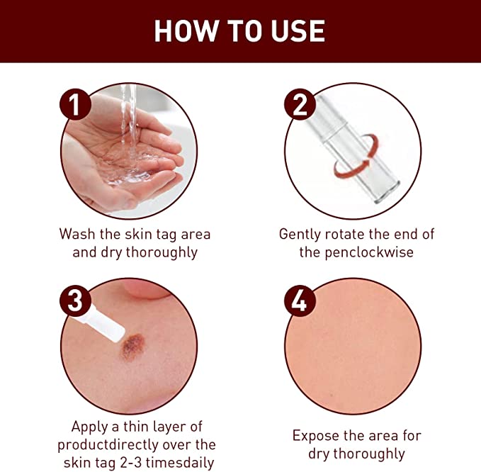 ClearMole™- Haut Tag &amp; Warze Entferner