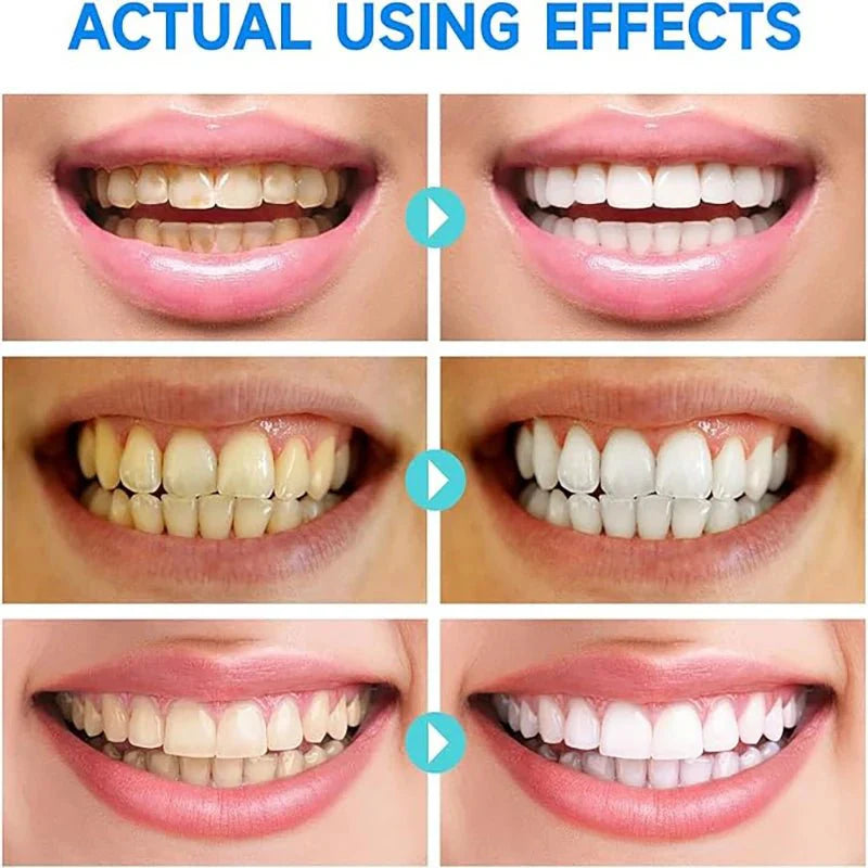 (1+1 GRATIS) PureTeeth™ Niacinamid Zahnaufhellung Zahnpasta
