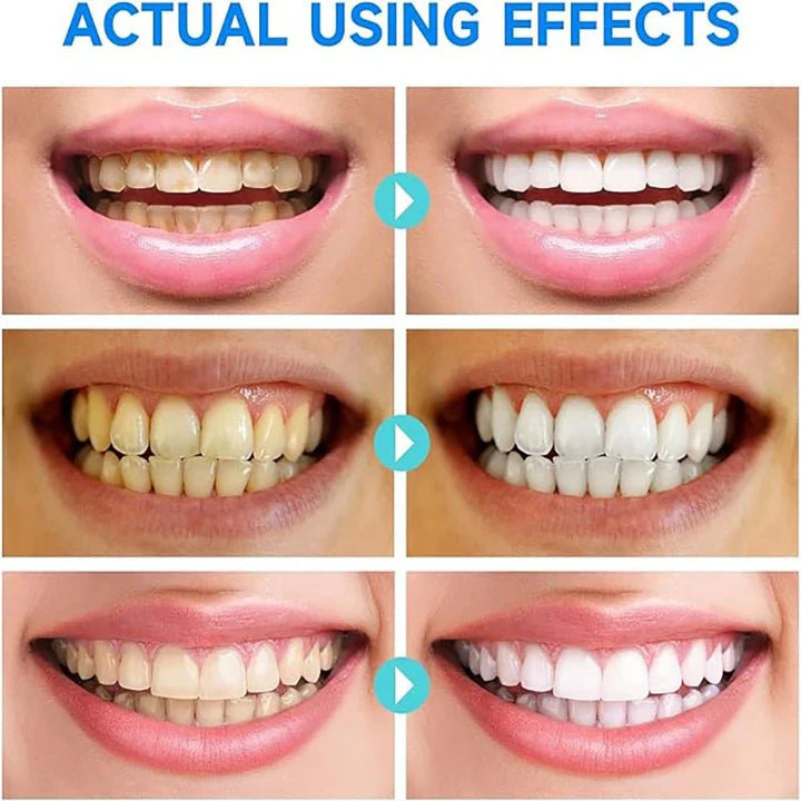 (1+1 GRATIS) PureTeeth™ Niacinamid Zahnaufhellung Zahnpasta